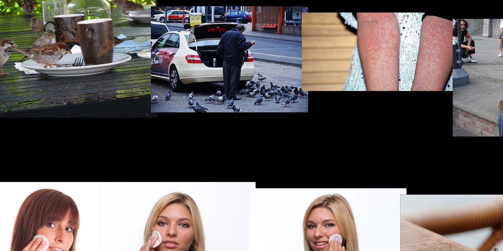mitesser
